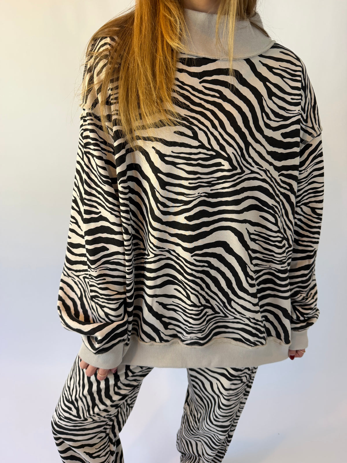 A person wearing a black and white zebra print long-sleeve top and matching pants against a plain white background.